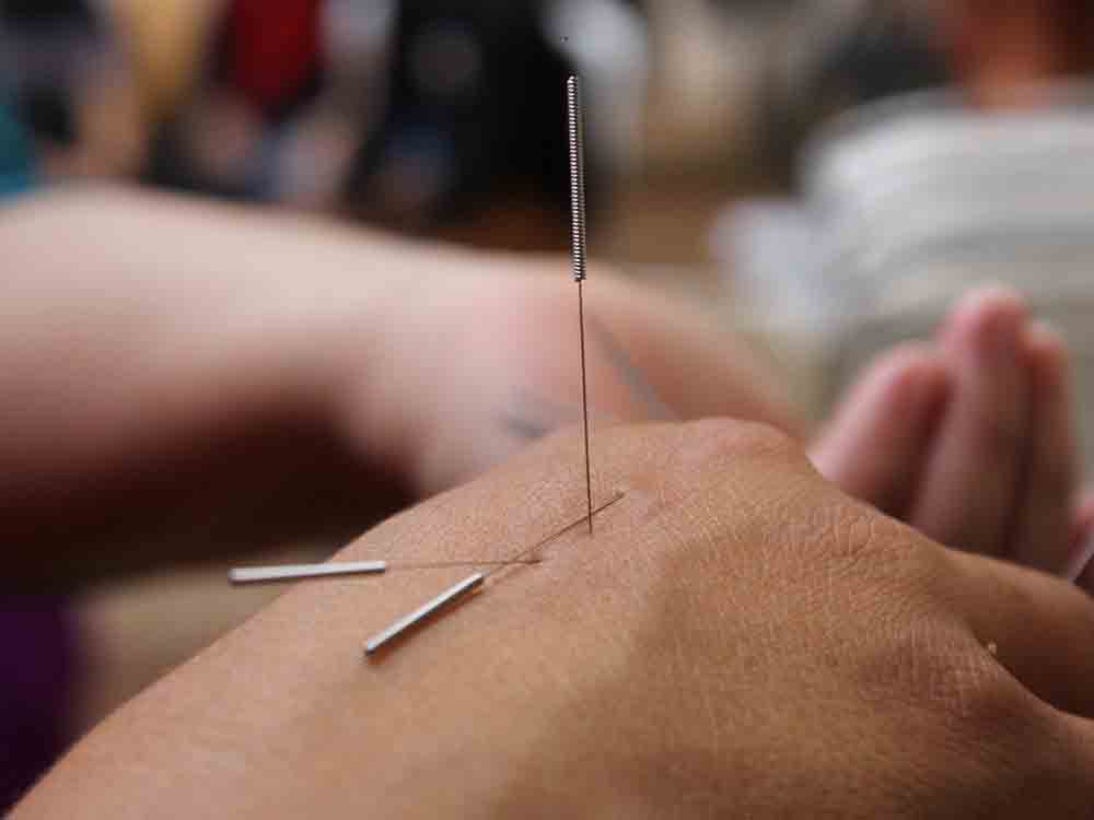 Akupunktur für Schwangere im Klinikum Gütersloh