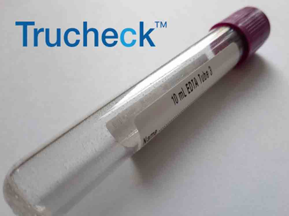 US FDA erteilt Breakthrough Device Designation für Bluttest zur Früherkennung von Brustkrebs
