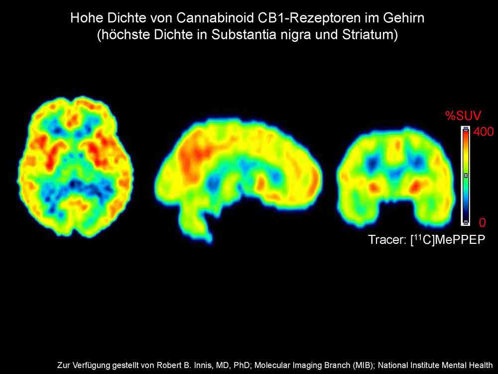 Erstmals nachgewiesen, zugelassenes Cannabinoid lindert Symptome bei Parkinson