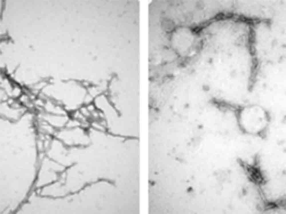 Nanokörper ordnen Eiweißklumpen im Hirn, Forscher ebnen Weg für neue Therapie gegen neurodegenerative Erkrankungen wie Alzheimer