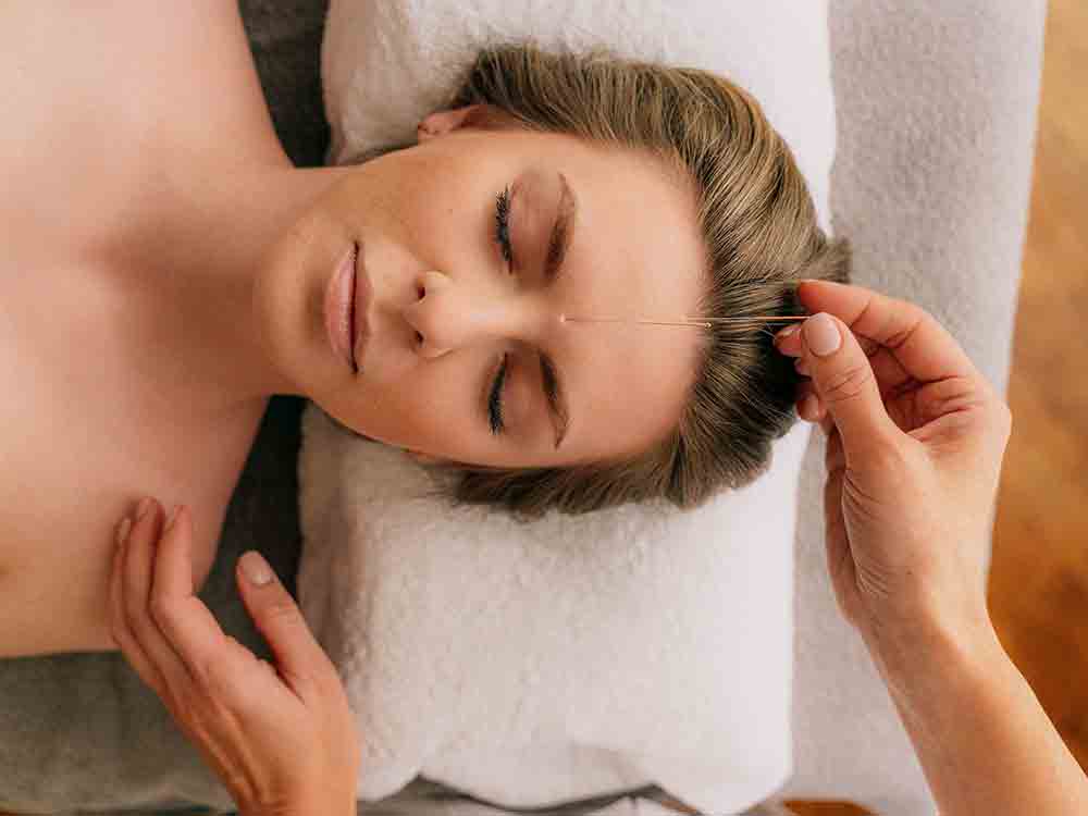 Akupunktur gegen Kopfschmerzen, die Therapie wird nicht von der Krankenkasse bezahlt, kann für einige aber eine Option sein