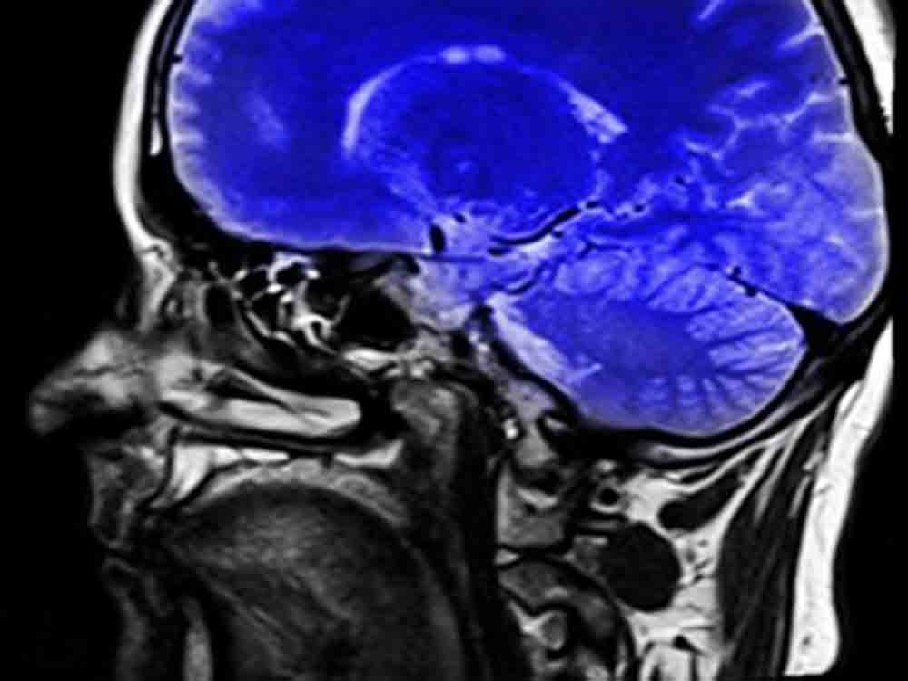 Ultraschall verringert Parkinson Symptome, »Exablate Neuro« verbessert Zittern und Mobilität bei 70 Prozent der betroffnenen Patienten