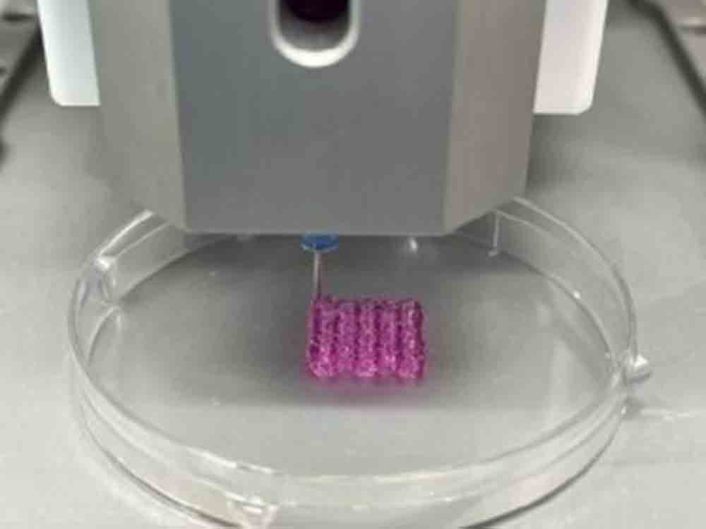 Neue 3D Bioprinting Technologie zerstört Tumore, südkoreanische Forscher setzen in Krebsbekämpfung auf natürliche Killerzellen
