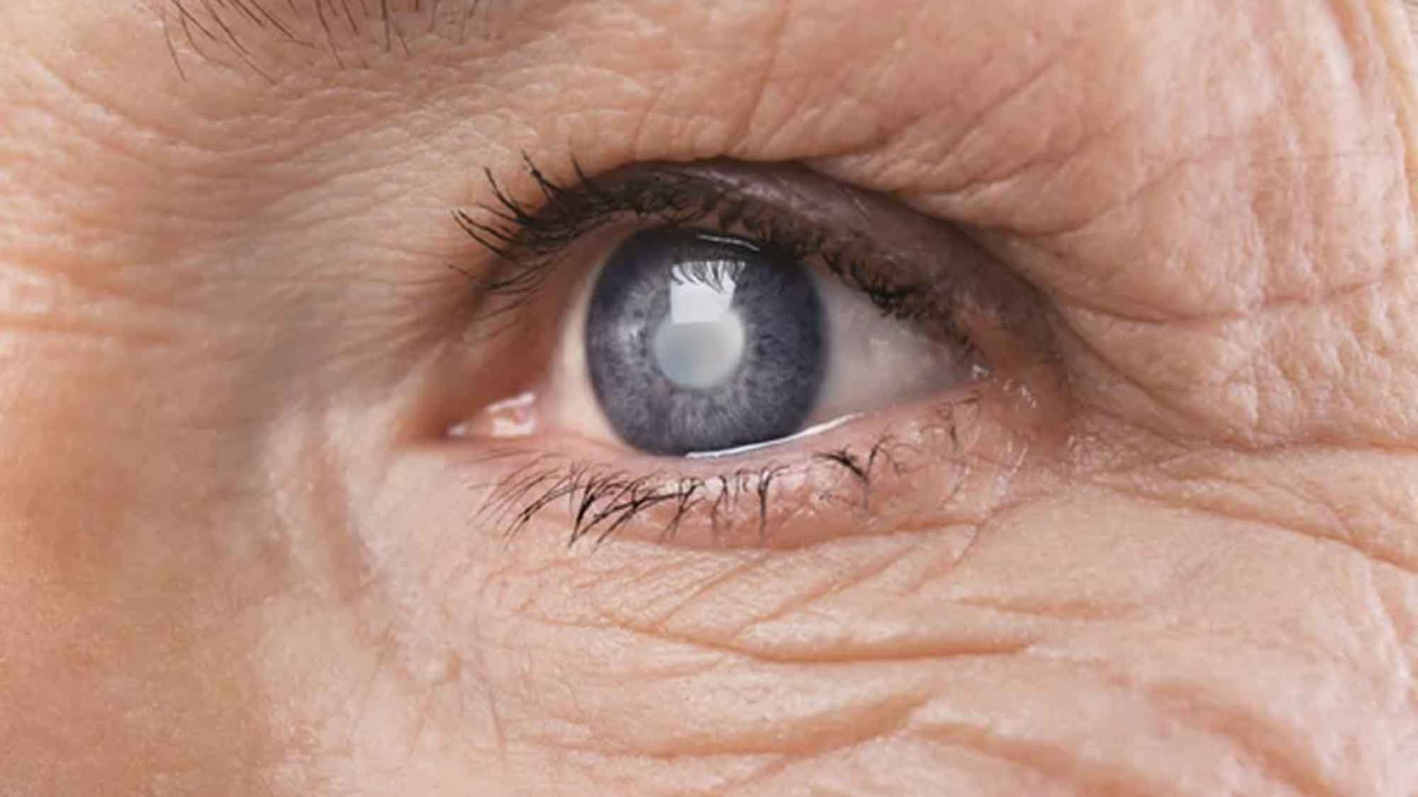 Augenarzt in Mainz: Wie Grauer Star das Autofahren einschränkt