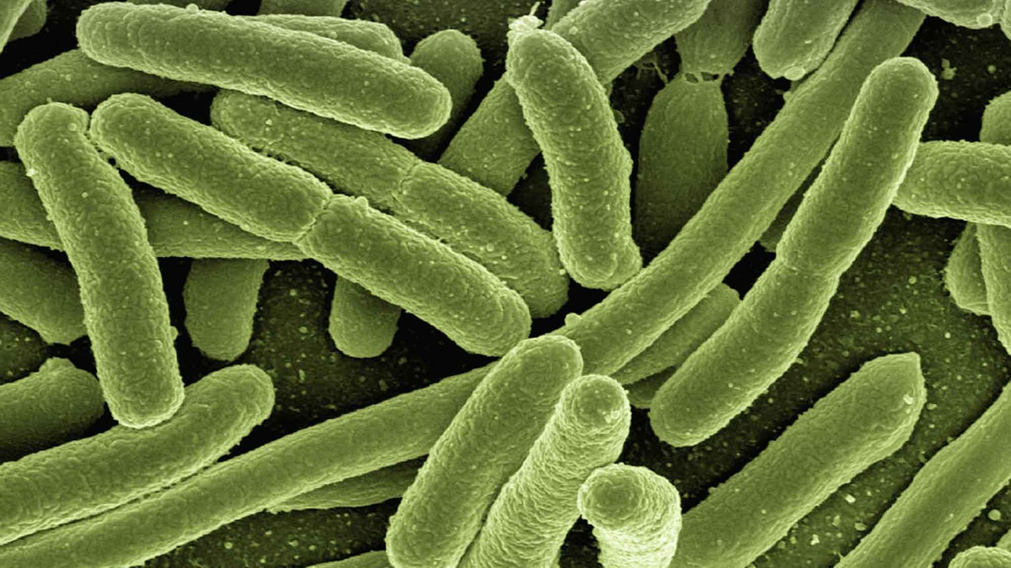 E. coli: Resistenzen nicht nur durch Antibiotika